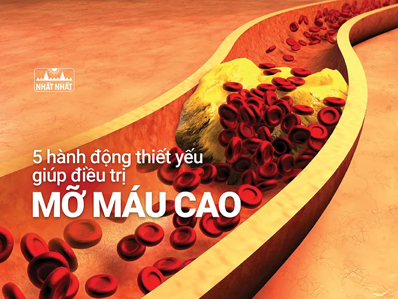 mỡ máu cao